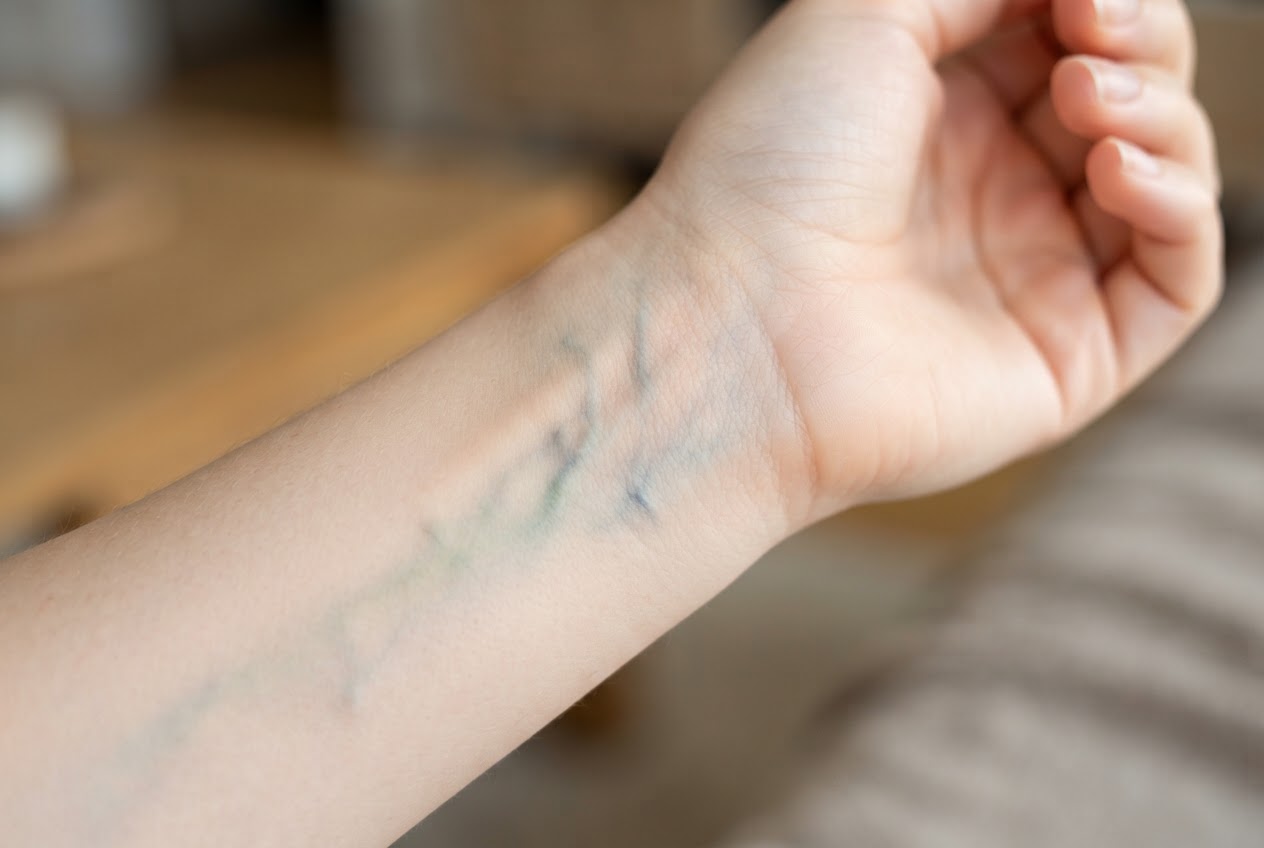 Close-up of the underside of a wrist showing greenish and bluish veins on pale skin.