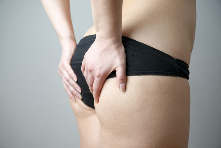Hausmittel gegen Cellulite