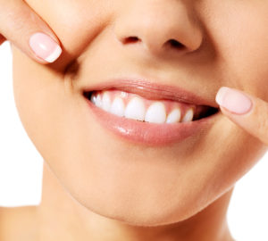 Zahnaufhellung im Test