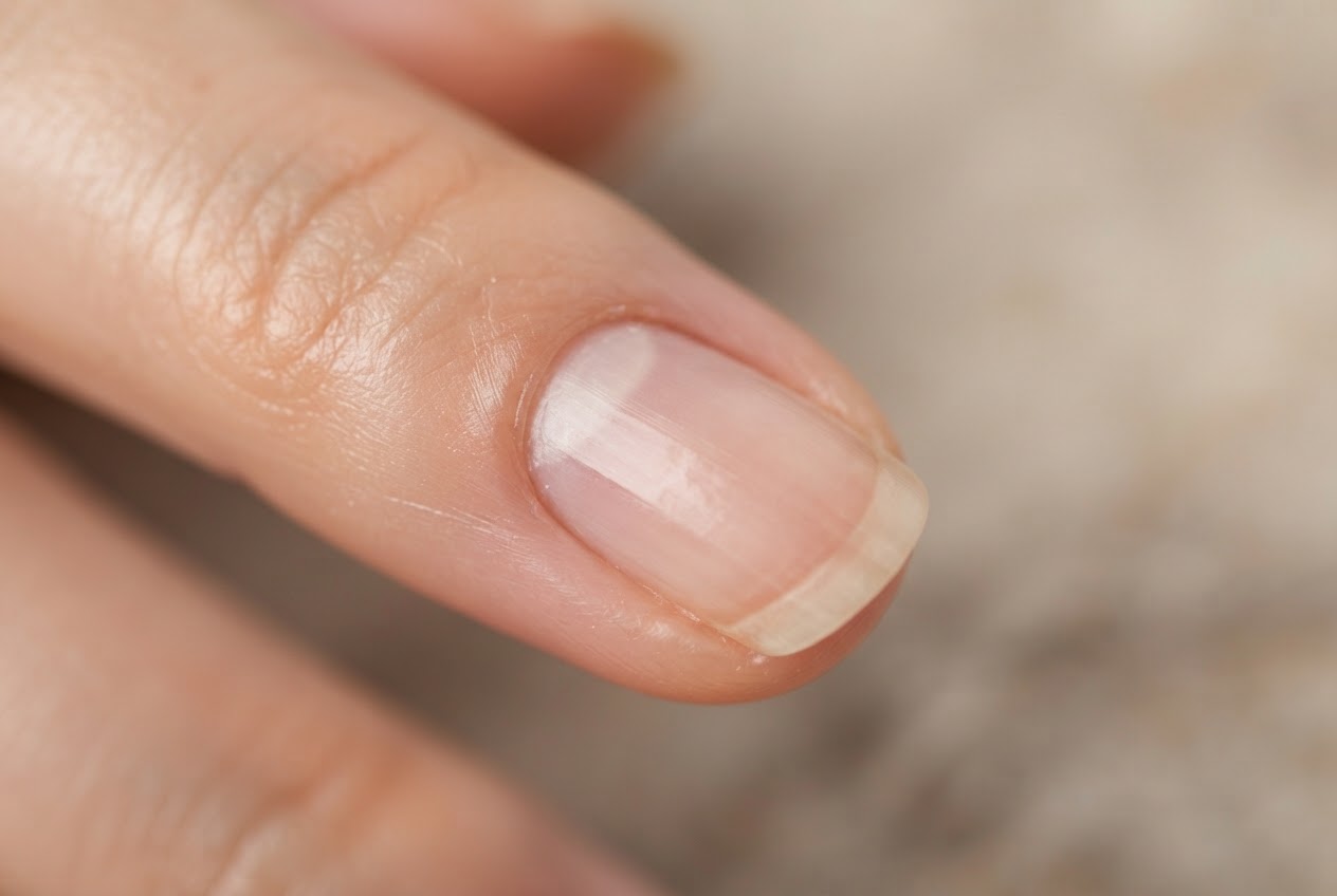 Close-up of a healthy fingernail showing the keratin structure and lunula
